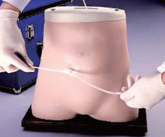 腹膜透析模型